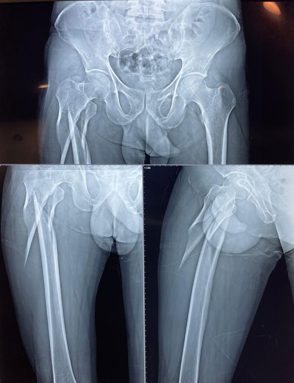 Trauma Case 1 Pre-Op