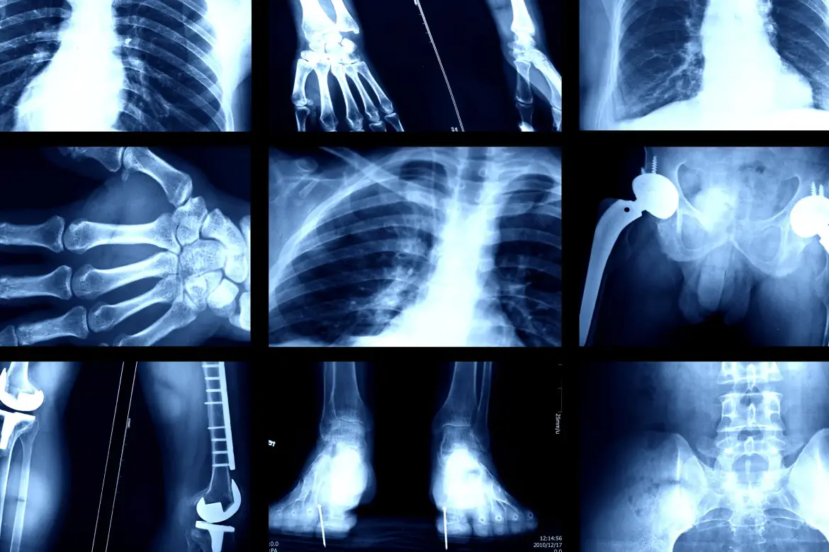 Digital X-Ray